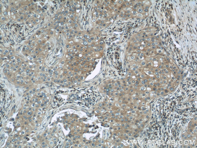 Cytochrome c Antibody in Immunohistochemistry (Paraffin) (IHC (P))