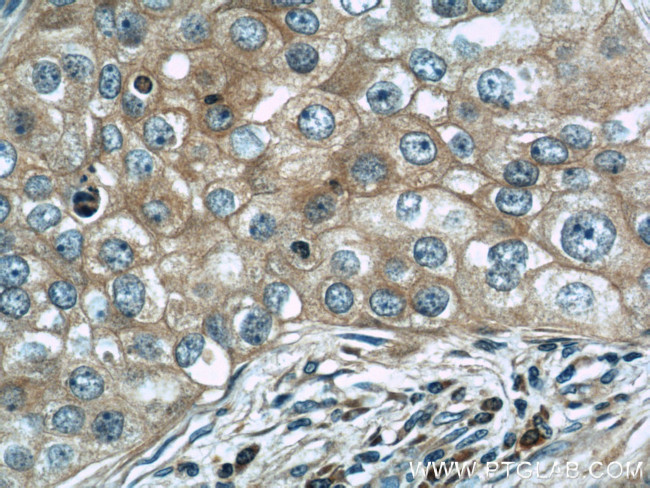 Cytochrome c Antibody in Immunohistochemistry (Paraffin) (IHC (P))