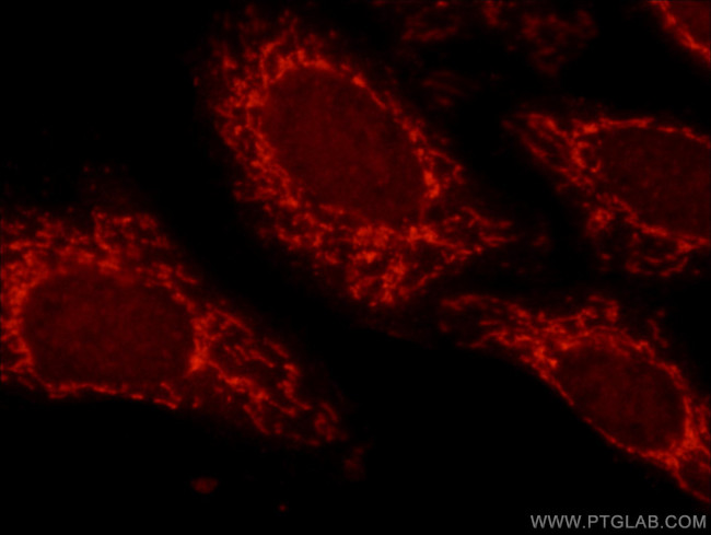 ATP5O Antibody in Immunocytochemistry (ICC/IF)