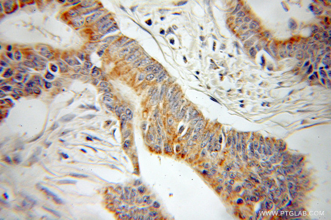 ATP5O Antibody in Immunohistochemistry (Paraffin) (IHC (P))