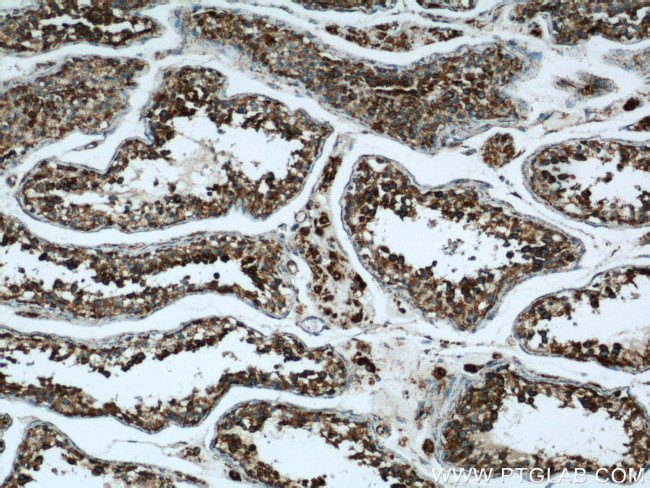 ATP5O Antibody in Immunohistochemistry (Paraffin) (IHC (P))