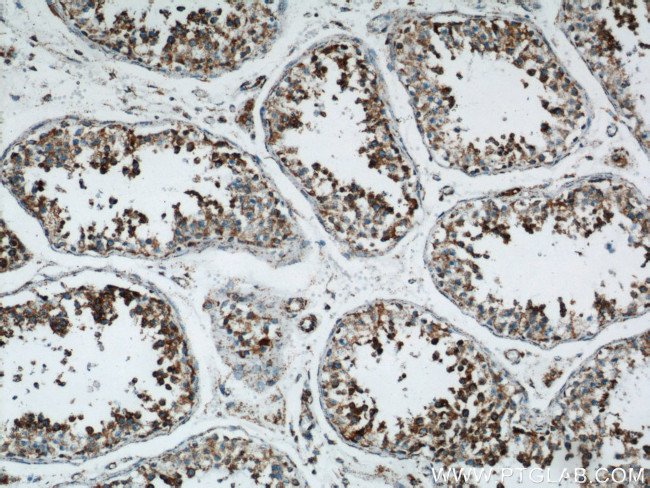 ATP5O Antibody in Immunohistochemistry (Paraffin) (IHC (P))