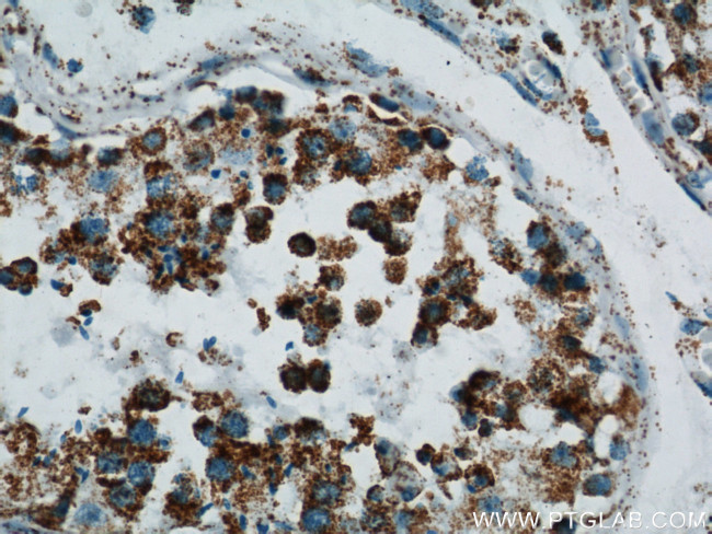 ATP5O Antibody in Immunohistochemistry (Paraffin) (IHC (P))