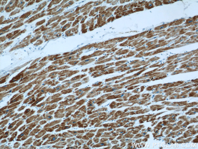 ATP5O Antibody in Immunohistochemistry (Paraffin) (IHC (P))