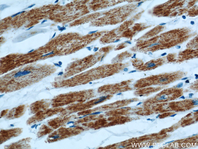 ATP5O Antibody in Immunohistochemistry (Paraffin) (IHC (P))