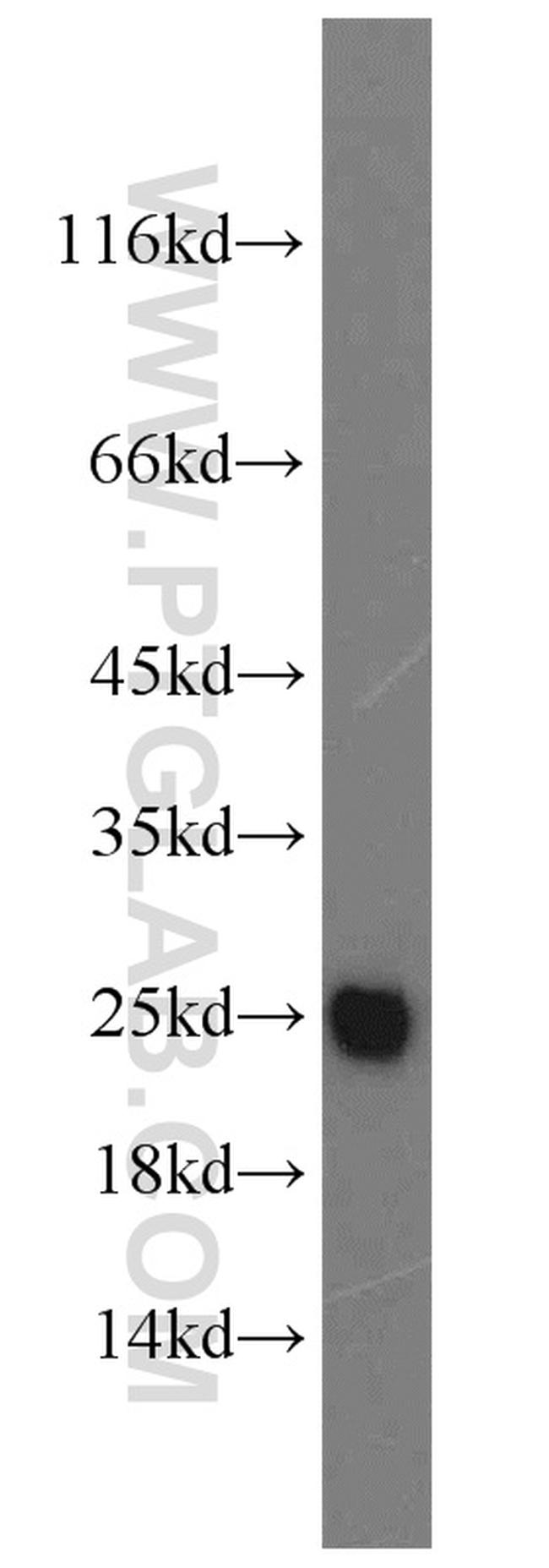 ATP5O Antibody in Western Blot (WB)