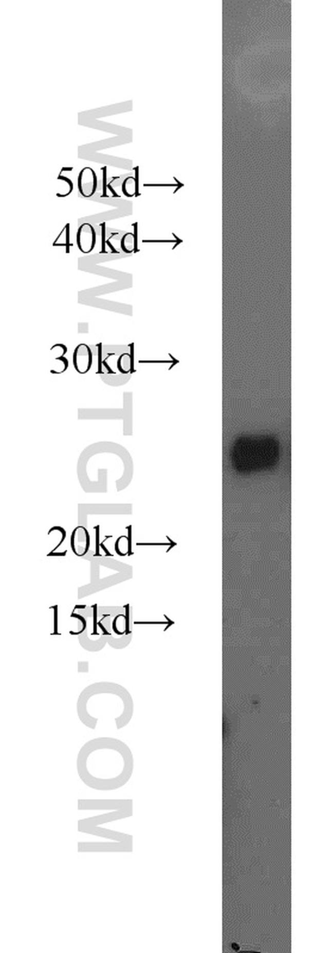 ATP5O Antibody in Western Blot (WB)