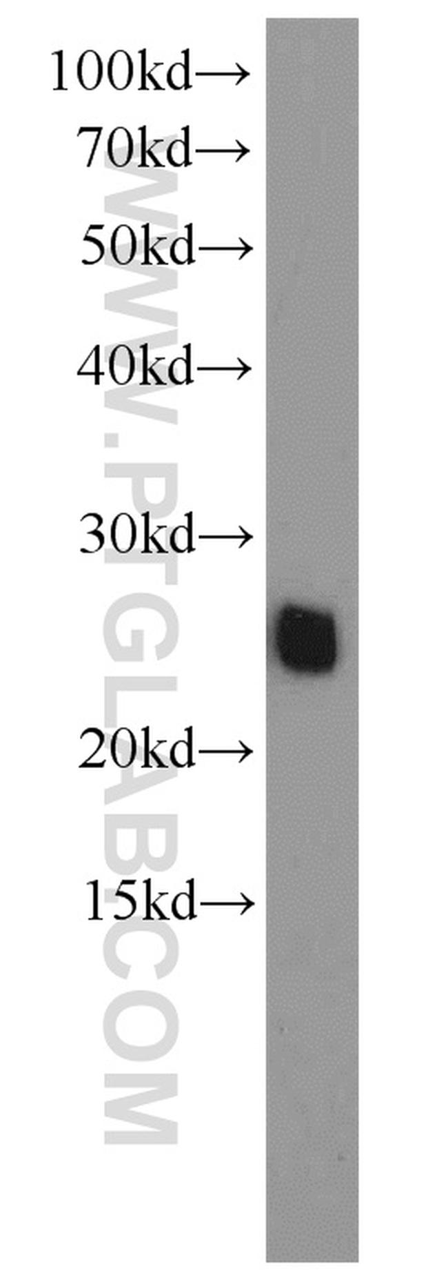 ATP5O Antibody in Western Blot (WB)