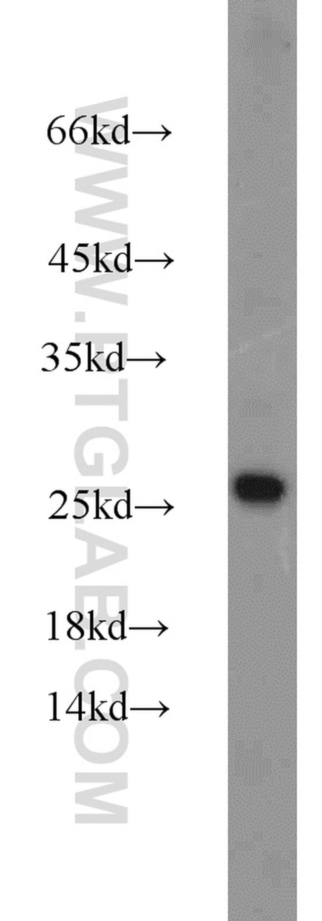 ATP5O Antibody in Western Blot (WB)