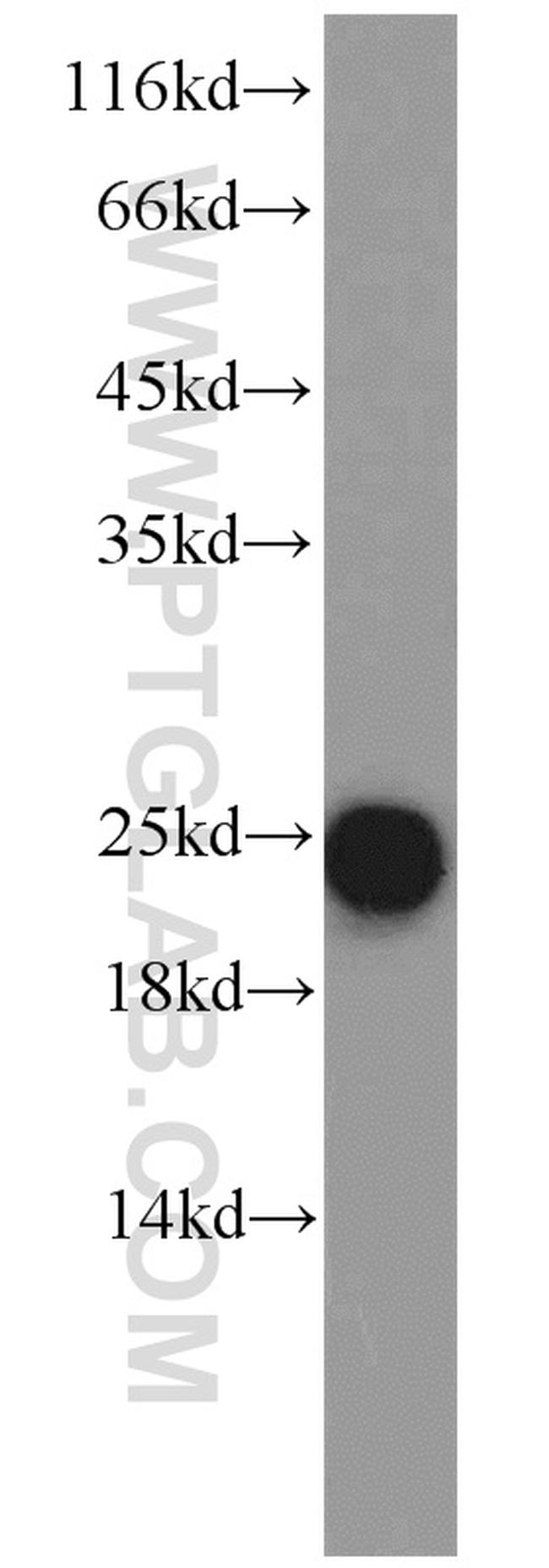 ATP5O Antibody in Western Blot (WB)