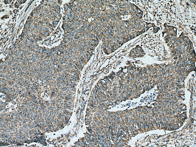 ATP5O Antibody in Immunohistochemistry (Paraffin) (IHC (P))