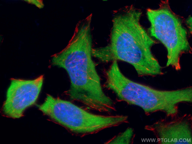 HSP70 Antibody in Immunocytochemistry (ICC/IF)