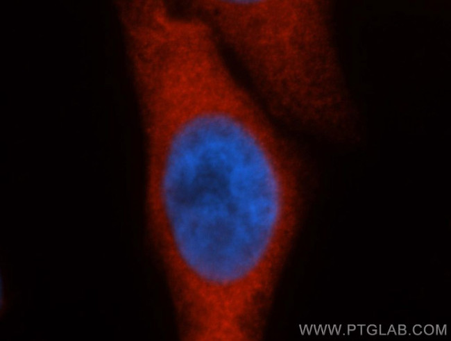 HSP70 Antibody in Immunocytochemistry (ICC/IF)