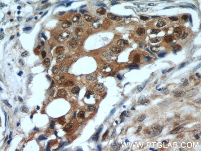 HSP70 Antibody in Immunohistochemistry (Paraffin) (IHC (P))