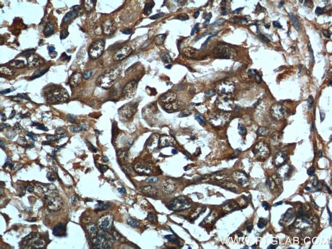 HSP70 Antibody in Immunohistochemistry (Paraffin) (IHC (P))