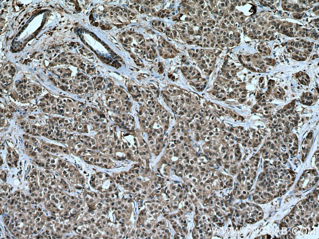 HSP70 Antibody in Immunohistochemistry (Paraffin) (IHC (P))