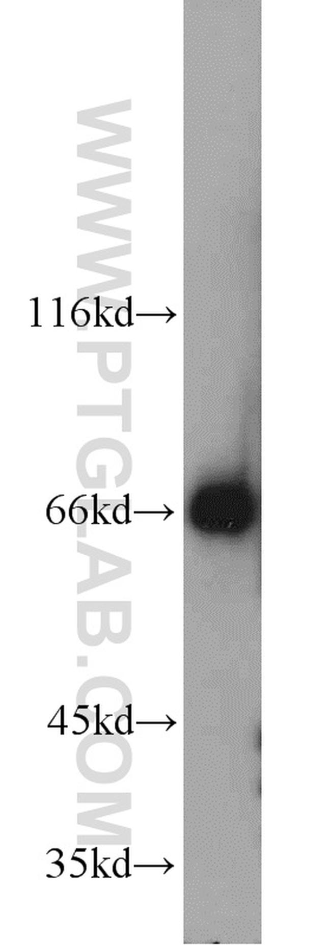 HSP70 Antibody in Western Blot (WB)