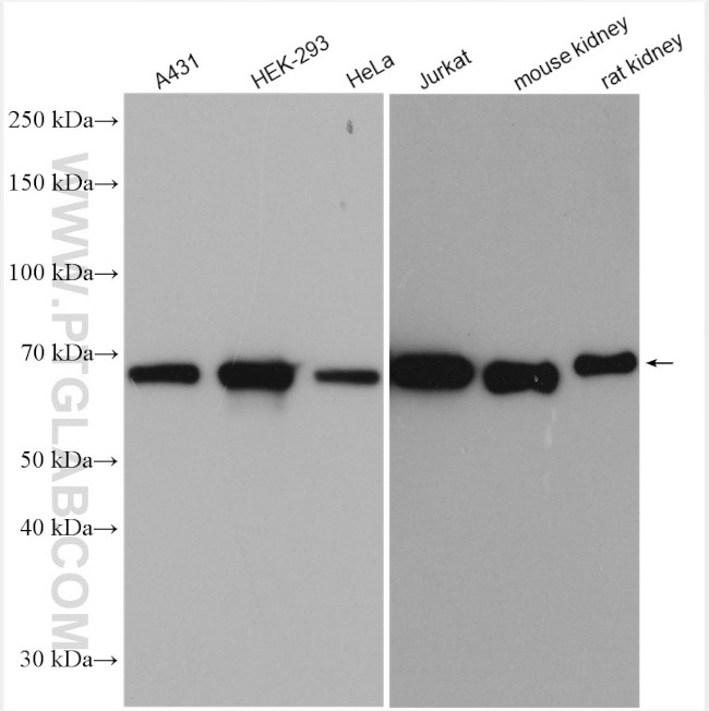 HSP70 Antibody in Western Blot (WB)