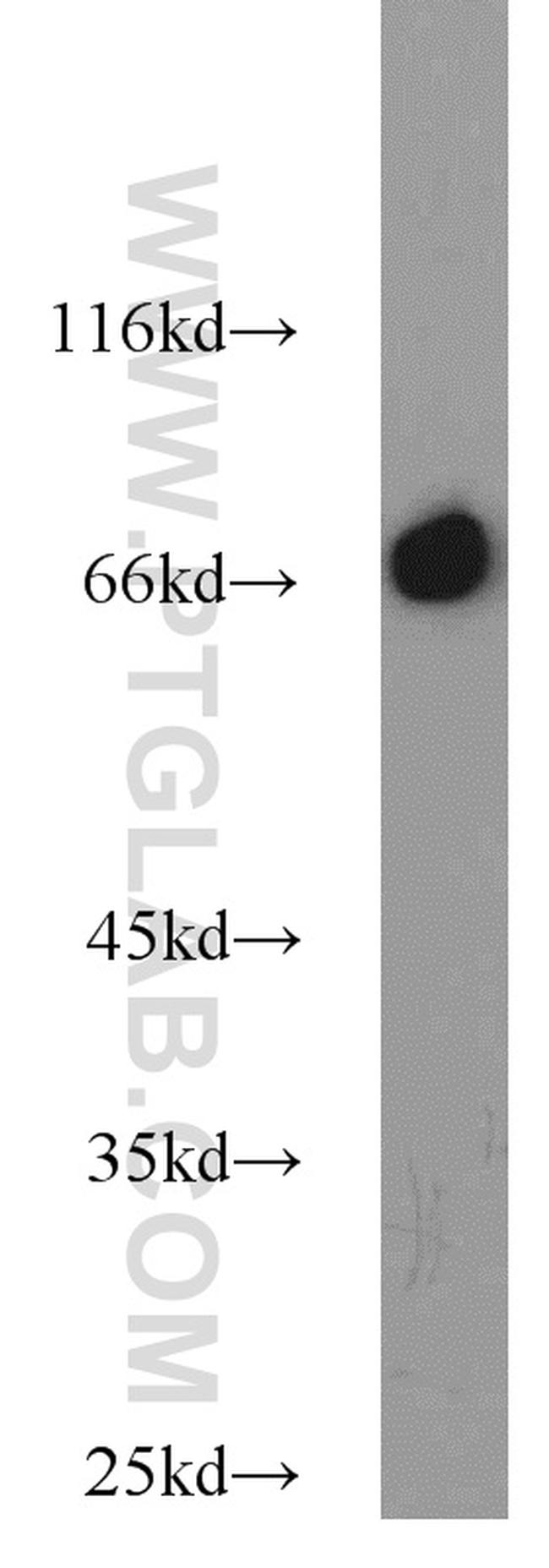 HSP70 Antibody in Western Blot (WB)