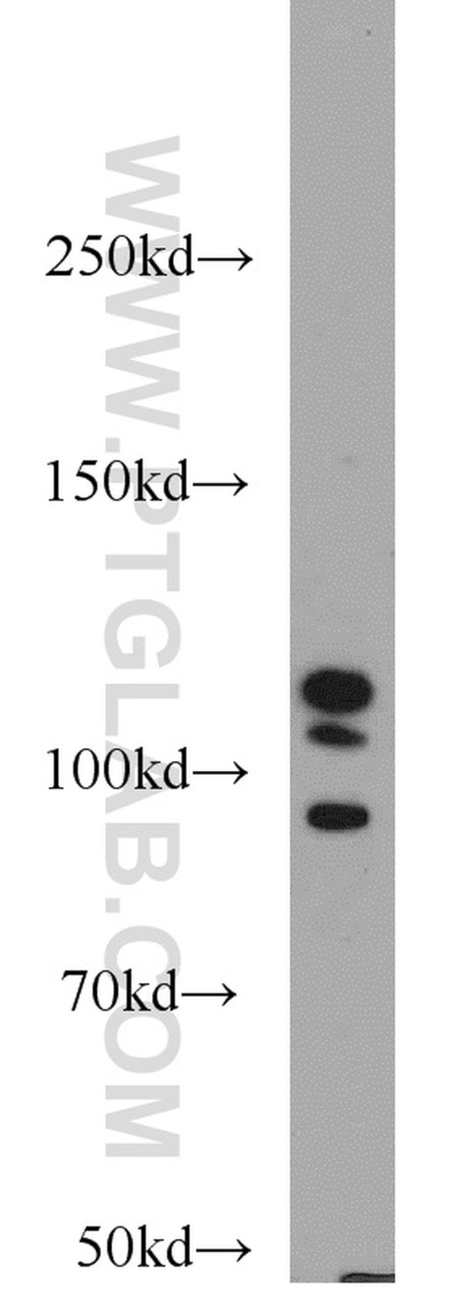 DGCR8 C-terminal Antibody in Western Blot (WB)