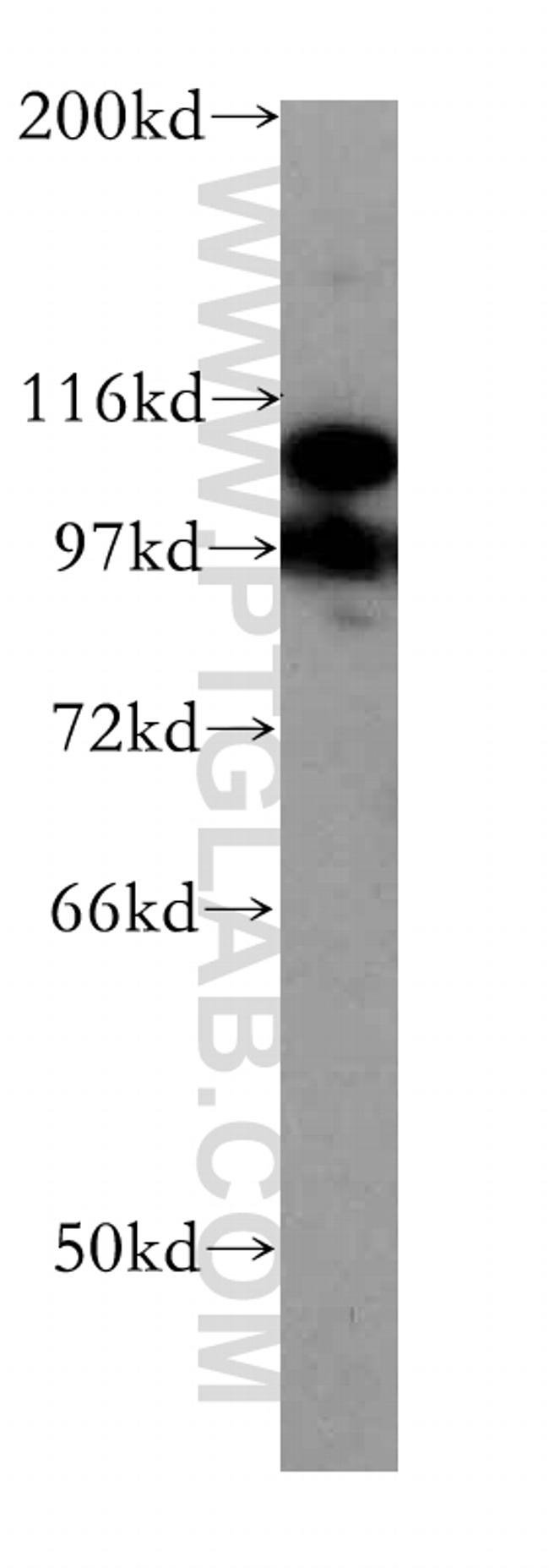 DGCR8 C-terminal Antibody in Western Blot (WB)