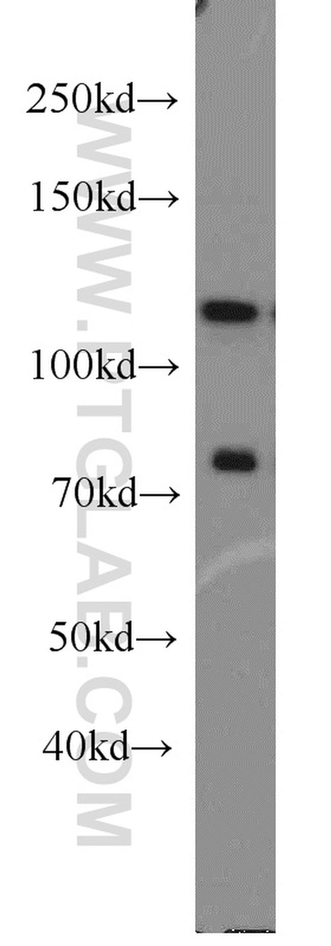 DGCR8 C-terminal Antibody in Western Blot (WB)