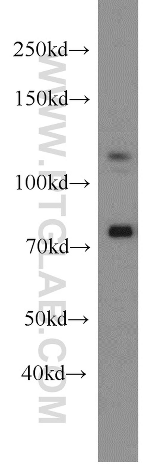 DGCR8 C-terminal Antibody in Western Blot (WB)