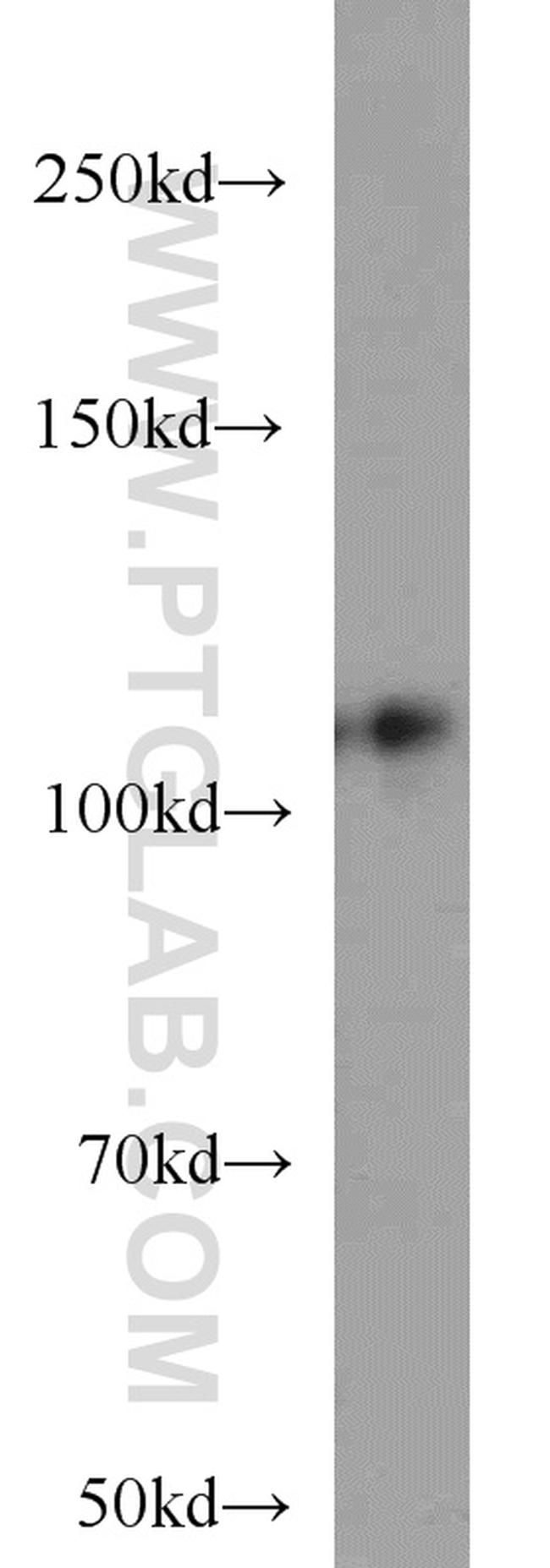 DGCR8 C-terminal Antibody in Western Blot (WB)