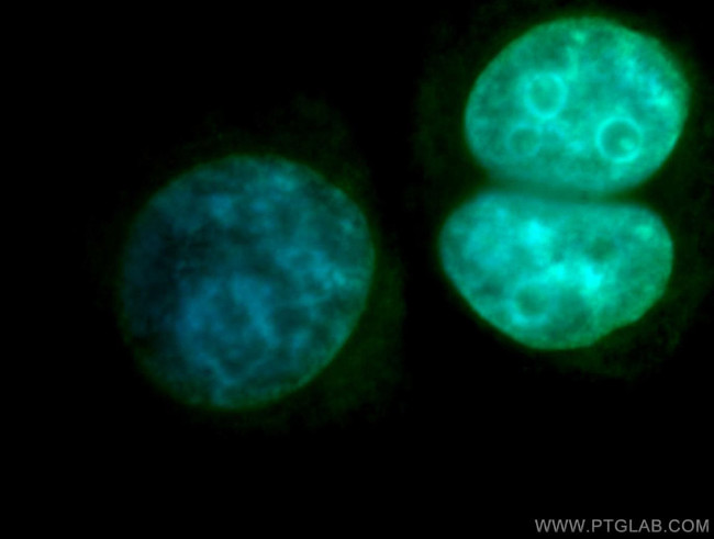 DGCR8 C-terminal Antibody in Immunocytochemistry (ICC/IF)