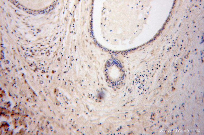 DGCR8 C-terminal Antibody in Immunohistochemistry (Paraffin) (IHC (P))