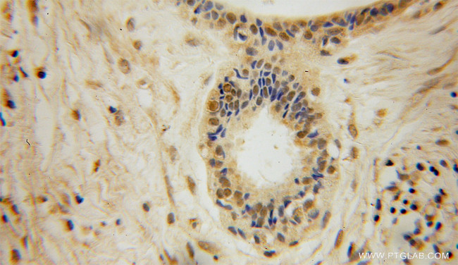 DGCR8 C-terminal Antibody in Immunohistochemistry (Paraffin) (IHC (P))