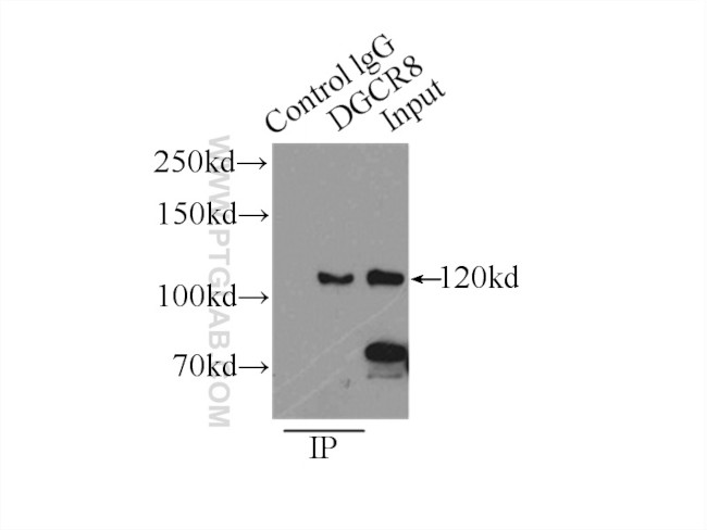 DGCR8 C-terminal Antibody in Immunoprecipitation (IP)