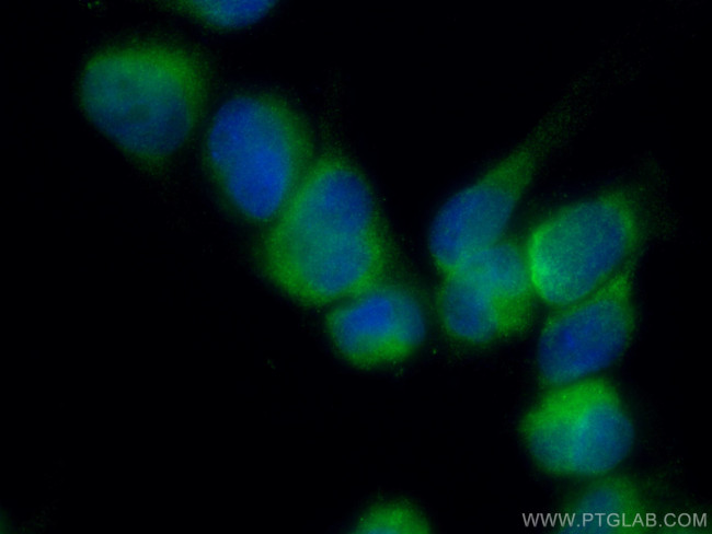 RAB32 Antibody in Immunocytochemistry (ICC/IF)