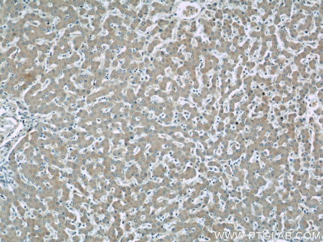 RAB32 Antibody in Immunohistochemistry (Paraffin) (IHC (P))