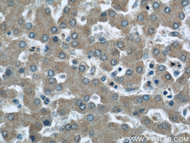 RAB32 Antibody in Immunohistochemistry (Paraffin) (IHC (P))