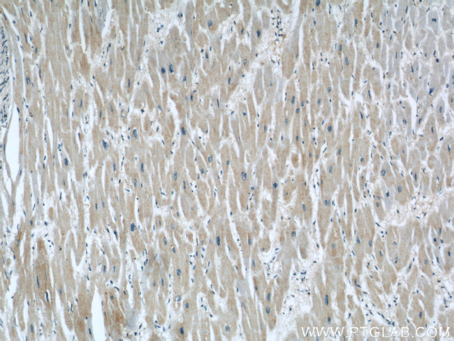 RAB32 Antibody in Immunohistochemistry (Paraffin) (IHC (P))