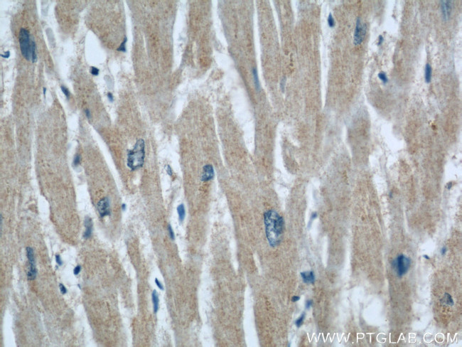 RAB32 Antibody in Immunohistochemistry (Paraffin) (IHC (P))