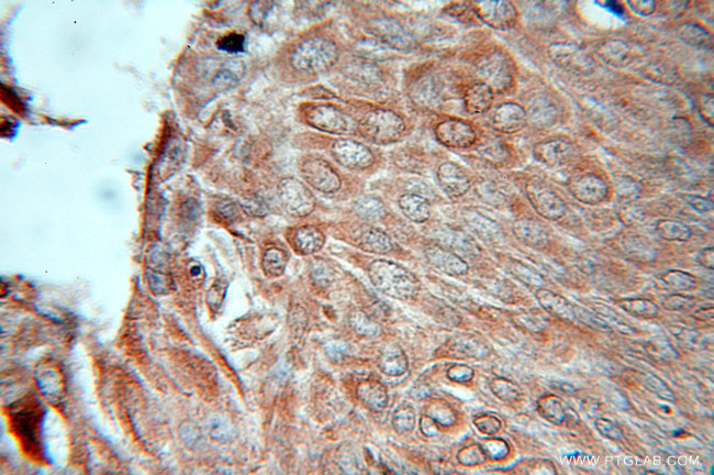 RAB32 Antibody in Immunohistochemistry (Paraffin) (IHC (P))