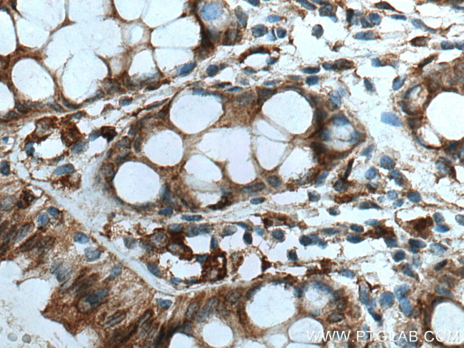 RAB32 Antibody in Immunohistochemistry (Paraffin) (IHC (P))