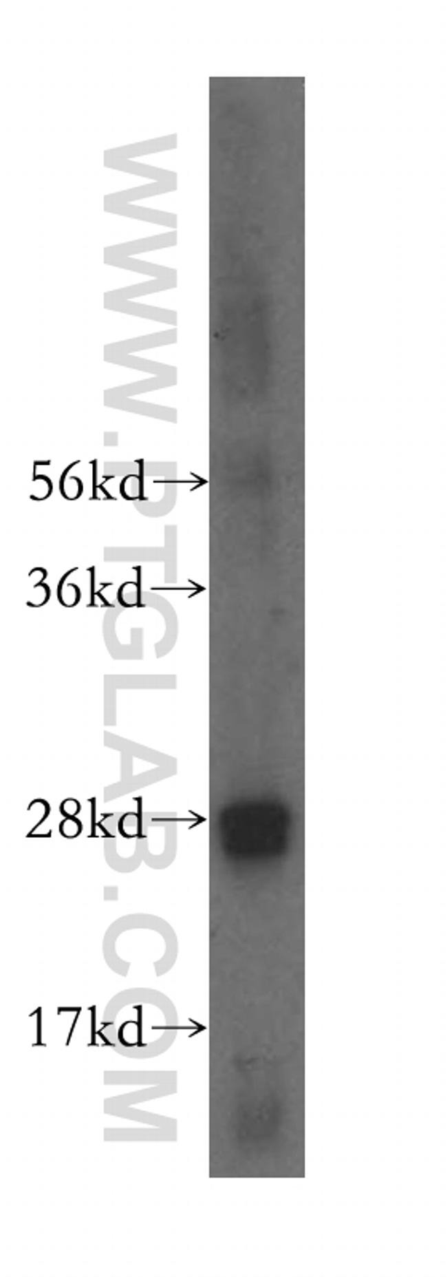 RAB32 Antibody in Western Blot (WB)