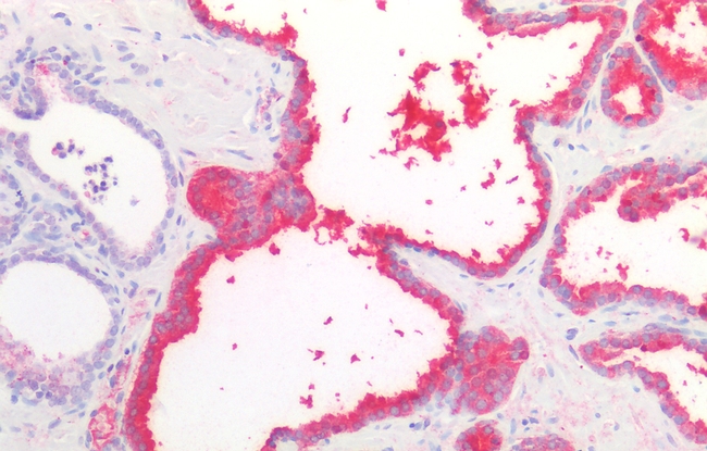 PSA Antibody in Immunohistochemistry (Paraffin) (IHC (P))