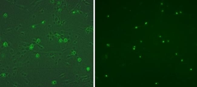 Mouse IgG (H+L) Secondary Antibody in Immunocytochemistry (ICC/IF)