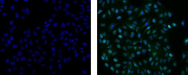 Mouse IgG2a Secondary Antibody in Immunocytochemistry (ICC/IF)