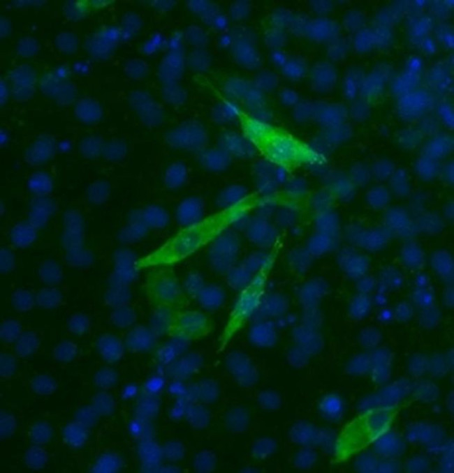 Mouse IgG2b Secondary Antibody in Immunohistochemistry (Paraffin) (IHC (P))