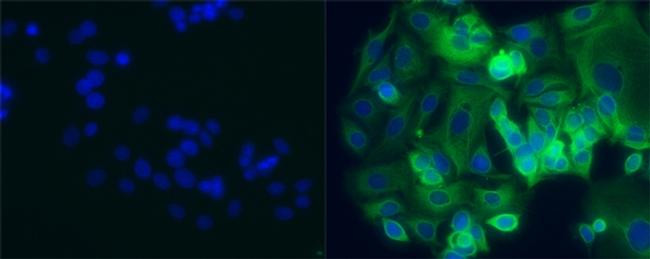 Mouse IgG1 kappa Isotype Control in Immunocytochemistry (ICC/IF)