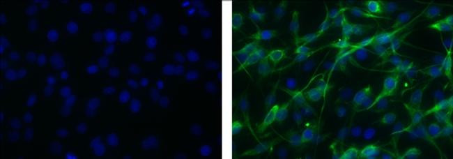 Mouse IgG1 kappa Isotype Control in Immunocytochemistry (ICC/IF)