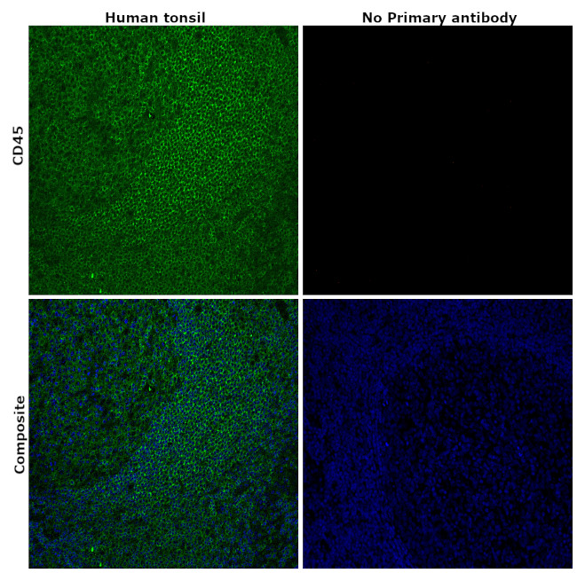 CD45 Antibody in Immunohistochemistry (Paraffin) (IHC (P))