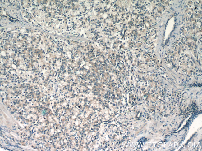 MIPEP Antibody in Immunohistochemistry (Paraffin) (IHC (P))