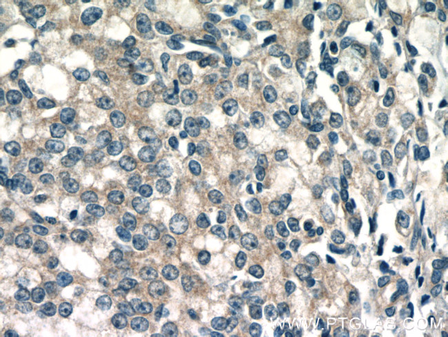 MIPEP Antibody in Immunohistochemistry (Paraffin) (IHC (P))