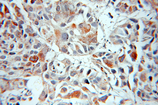 MIPEP Antibody in Immunohistochemistry (Paraffin) (IHC (P))